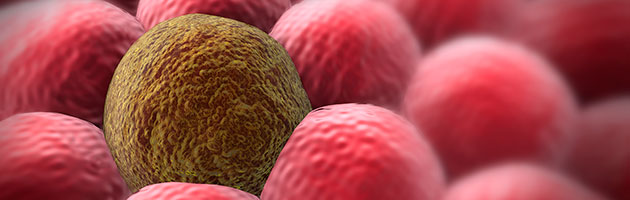 el cancer se alimenta de azucar